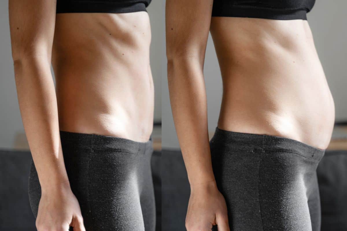 How long does diastasis recti take to improve Stourbridge?