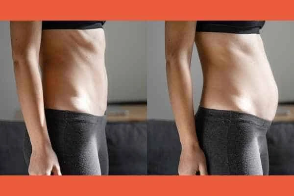 LA-EMS Body Sculpting results Stourbridge