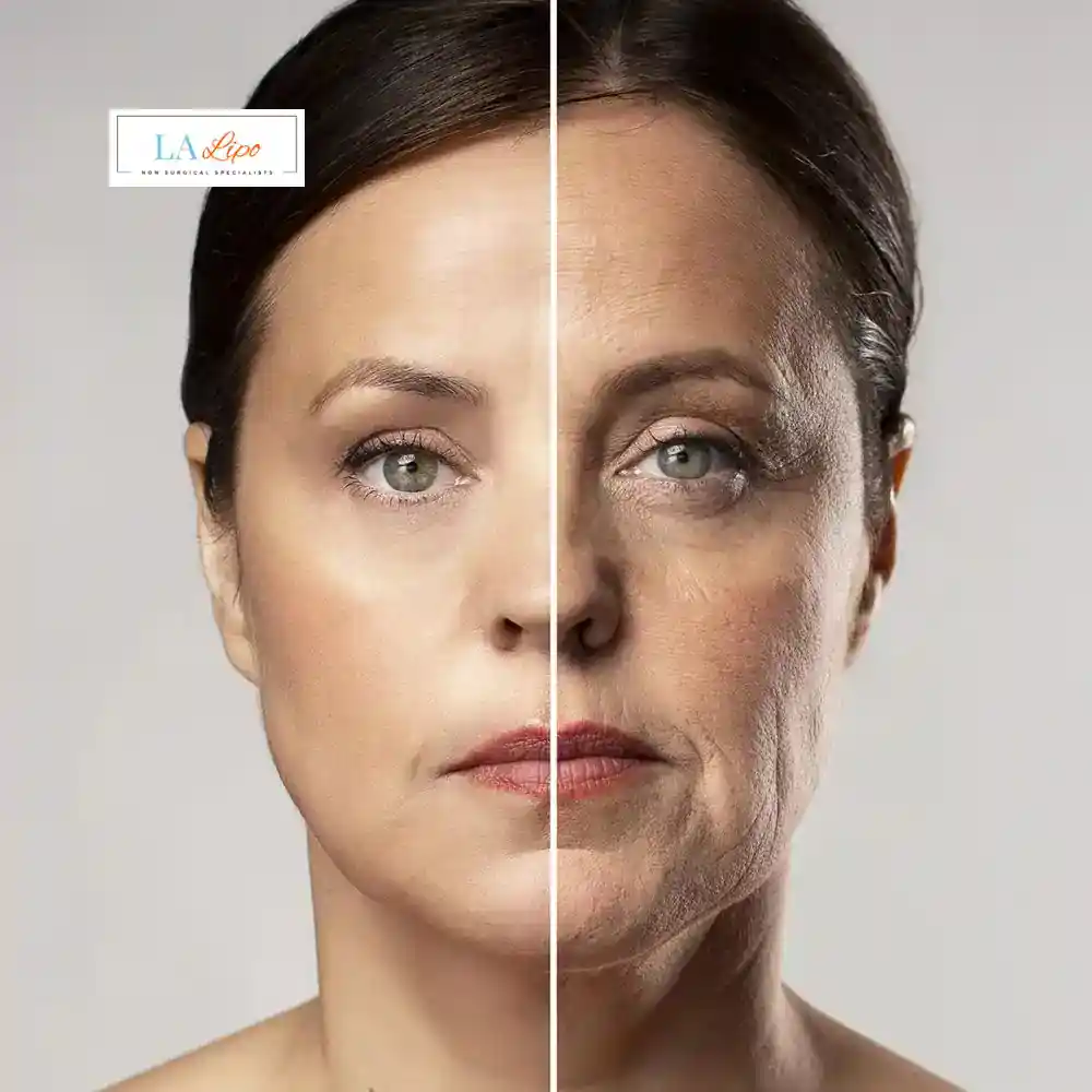 How Can You Tell If Non-Surgical Skin Tightening Is Right for You Stourbridge?