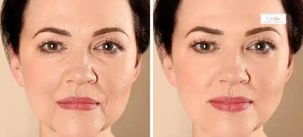 Why Aren’t My Skincare Products Making My Sagging Skin Look Firmer Stourbridge?